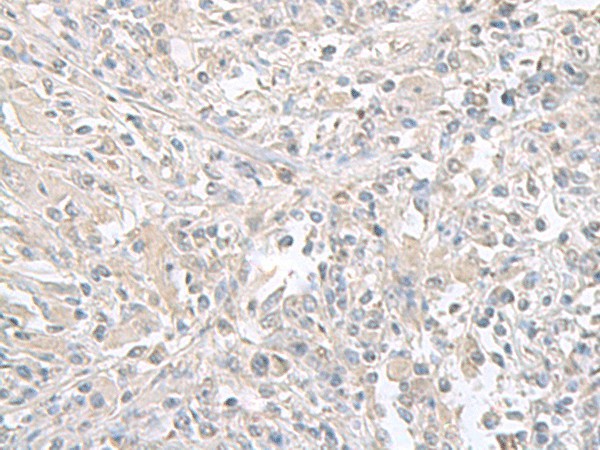 FXYD6 Polyclonal Antibody (E-AB-52673)