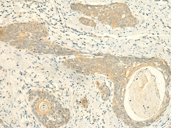 MPV17 Polyclonal Antibody (E-AB-18917)