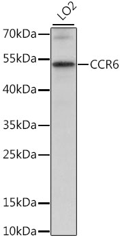 CCR6 Polyclonal Antibody (E-AB-66724)