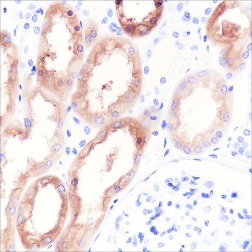 Recombinant HGD Monoclonal Antibody (AN301717L)