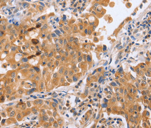 BLNK Polyclonal Antibody (E-AB-16280)