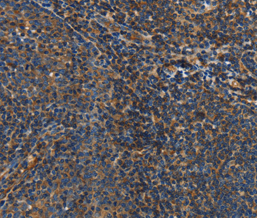 IL17D Polyclonal Antibody (E-AB-16510)