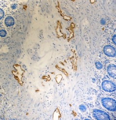 Purified anti-Podoplanin (Lymphatic Endothelial Marker) Antibody