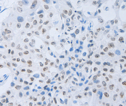 c-Fms Polyclonal Antibody (E-AB-12561)