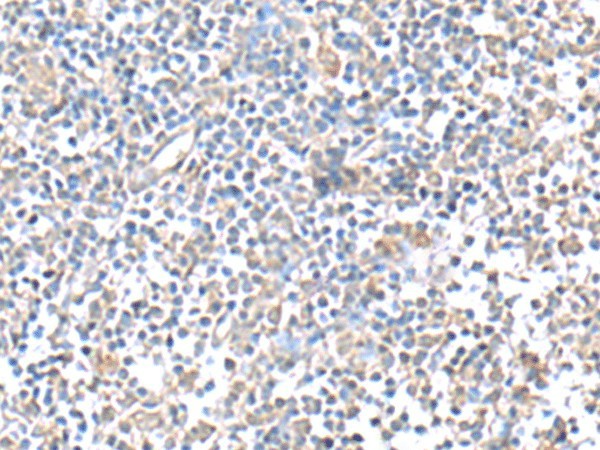 IFI27 Polyclonal Antibody (E-AB-53022)