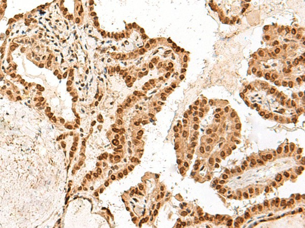 ARMC8 Polyclonal Antibody (E-AB-52619)