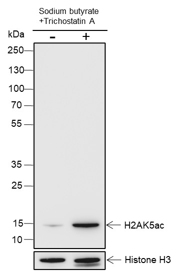 Recombinant Histone H2A (Acetyl Lys5) Monoclonal Antibody (AN301414L)