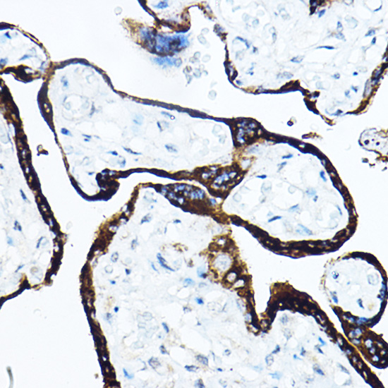 GH1 Polyclonal Antibody (E-AB-92796)