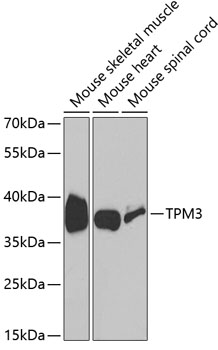 TPM3 Polyclonal Antibody (E-AB-65867)