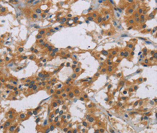 IL18R1 Polyclonal Antibody (E-AB-10105)