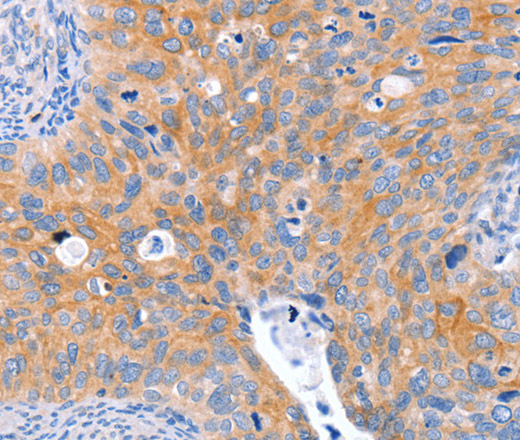 ABO Polyclonal Antibody (E-AB-16281)