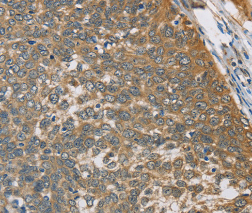TNFRSF10D Polyclonal Antibody (E-AB-14934)
