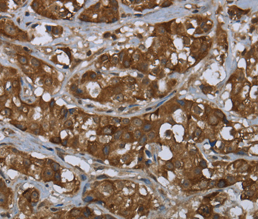 PIP Polyclonal Antibody (E-AB-15061)