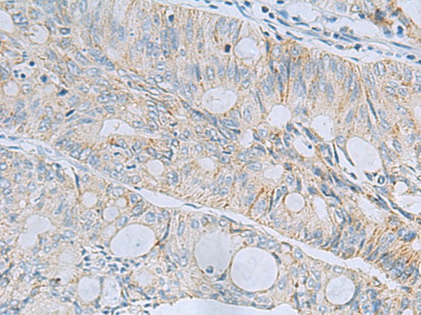MSI2 Polyclonal Antibody (E-AB-19233)