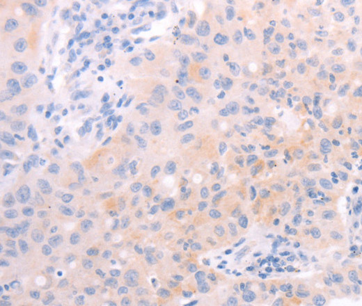 AMH Polyclonal Antibody (E-AB-15915)