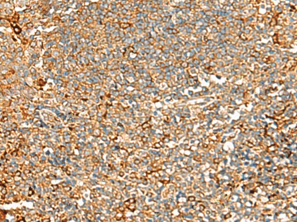 ASMTL Polyclonal Antibody (E-AB-18738)