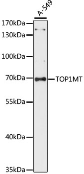 TOP1MT Polyclonal Antibody (E-AB-65363)