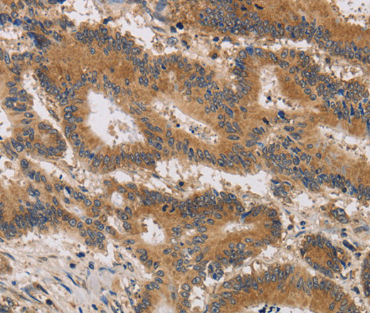 ITIH1 Polyclonal Antibody (E-AB-16528)