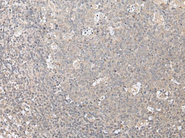 ZFYVE1 Polyclonal Antibody (E-AB-18448)