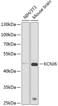KCNJ6 Polyclonal Antibody (E-AB-68037)