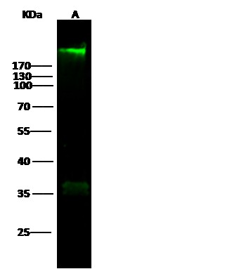 Recombinant Fibronectin Fragment 2 Monoclonal Antibody (AN300318P)