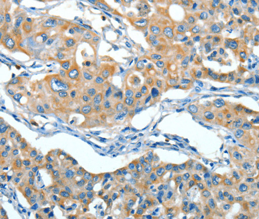 SERPINA3 Polyclonal Antibody (E-AB-10777)
