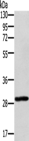 EDA2R Polyclonal Antibody (E-AB-11177)