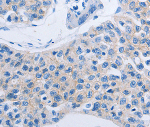 HOXA6 Polyclonal Antibody (E-AB-10369)