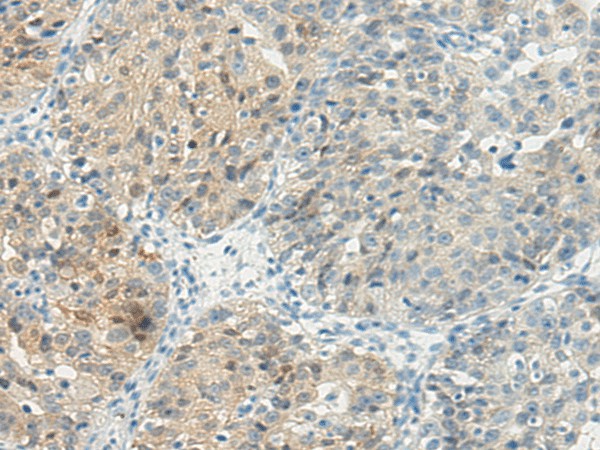 TBXA2R Polyclonal Antibody (E-AB-17491)