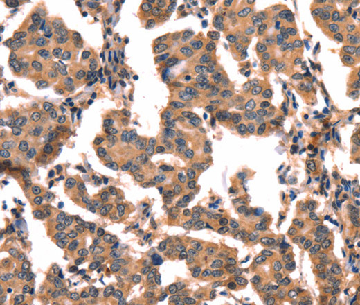 hCG Polyclonal Antibody (E-AB-14867)