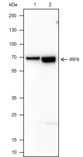 Recombinant IRF6 Monoclonal Antibody (AN301696L)