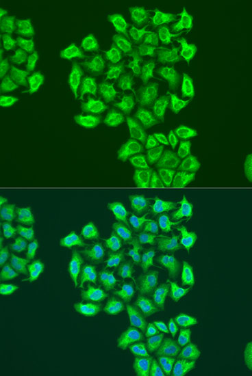 BNIP3 Polyclonal Antibody (E-AB-66396)