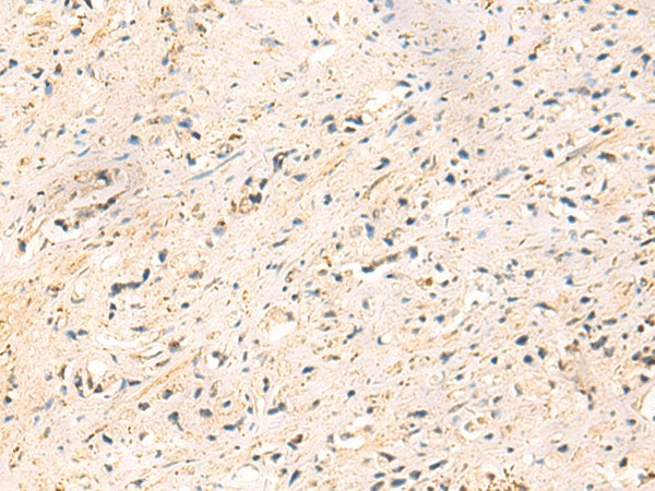IP6K3 Polyclonal Antibody (E-AB-52013)