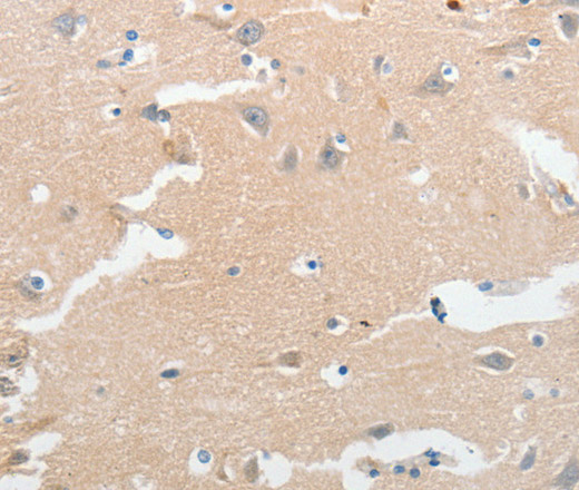 LCN2 Polyclonal Antibody (E-AB-12805)