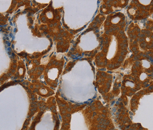 PARP3 Polyclonal Antibody (E-AB-11473)