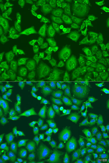 KIF11 Polyclonal Antibody (E-AB-62806)
