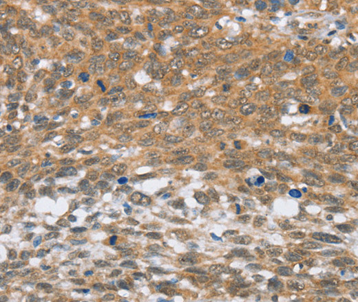 MLH1 Polyclonal Antibody (E-AB-14226)