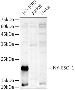 CTAG1B Polyclonal Antibody (E-AB-68429)