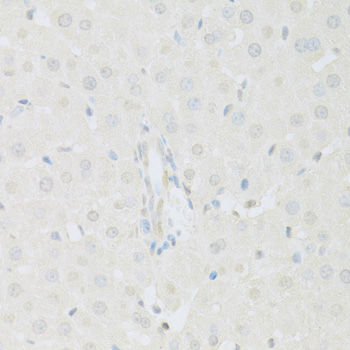 KAT2A Polyclonal Antibody (E-AB-65395)