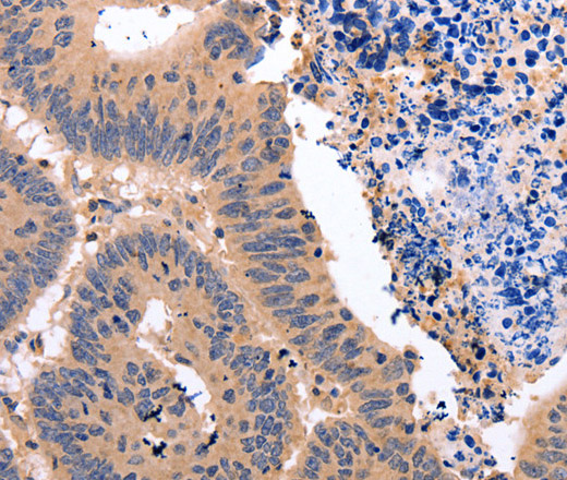 Glucocorticoid Receptor Polyclonal Antibody (E-AB-15695)
