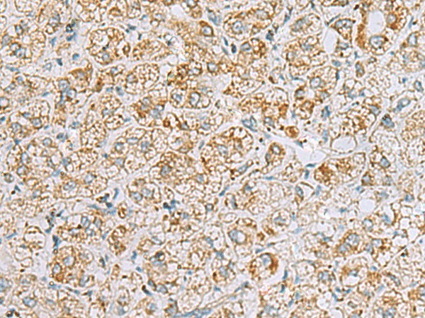 INS(C-peptide) Polyclonal Antibody (E-AB-19628)