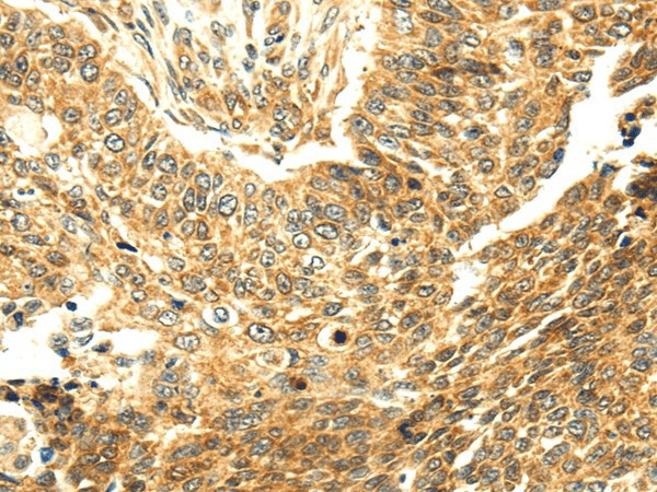 SERPINA12 Polyclonal Antibody (E-AB-17025)