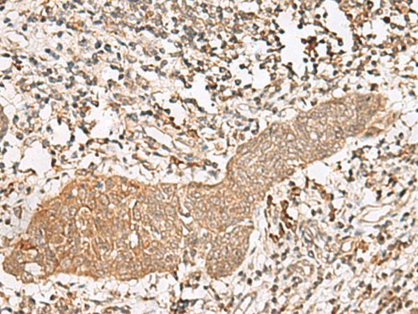 FGF13 Polyclonal Antibody (E-AB-17962)
