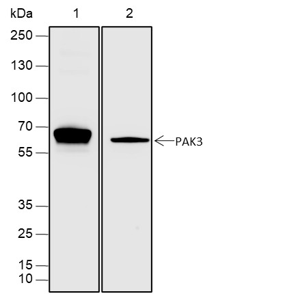Recombinant PAK3 Monoclonal Antibody (AN301617L)