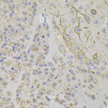REG3A Polyclonal Antibody (E-AB-64197)