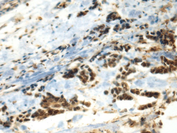 DDX39A Polyclonal Antibody (E-AB-52576)