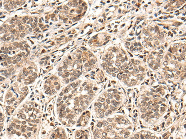 HGH1 Polyclonal Antibody (E-AB-19647)