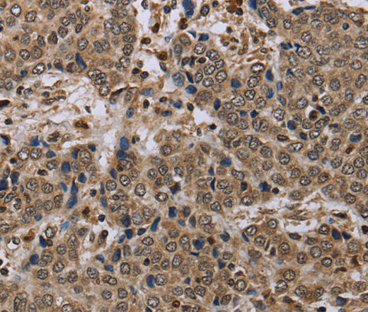 NLRP4 Polyclonal Antibody (E-AB-13437)