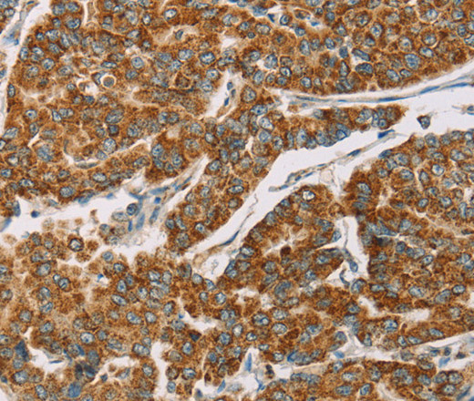 DLL4 Polyclonal Antibody (E-AB-11160)