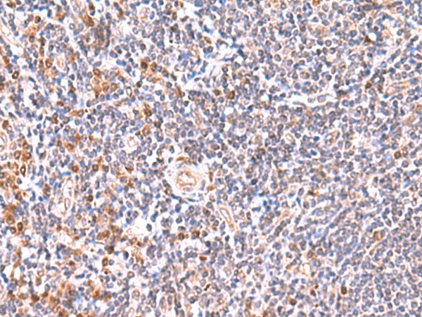 GMDS Polyclonal Antibody (E-AB-52916)